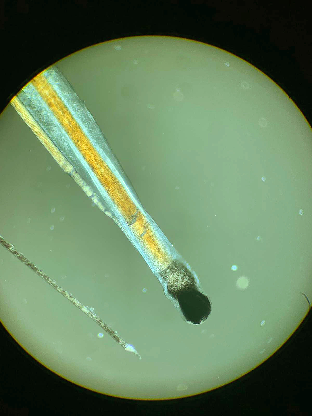 Bulbo del capello al microscopio a luce polarizzata