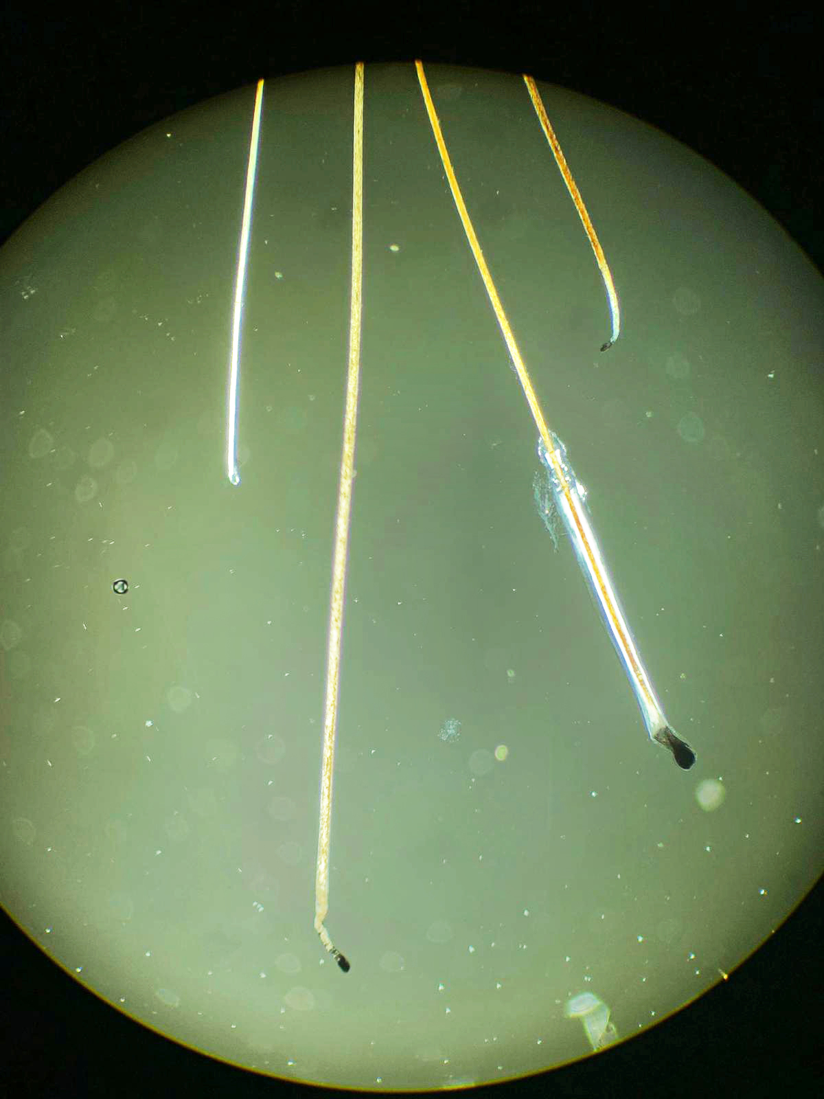 Capelli al microscopio a luce polarizzata: riduzione del ciclo follicolare