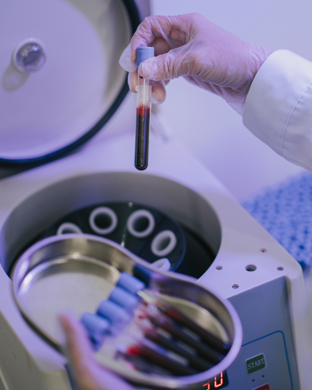 centrifuga con fiale contenente plasma