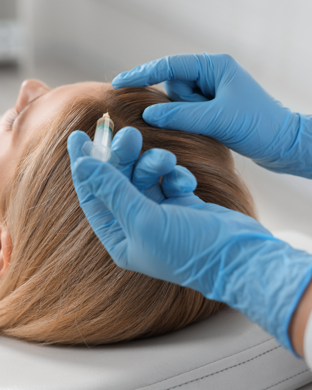 inizezione cute capello donna