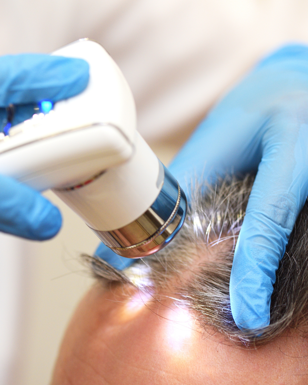 microscopio su capelli